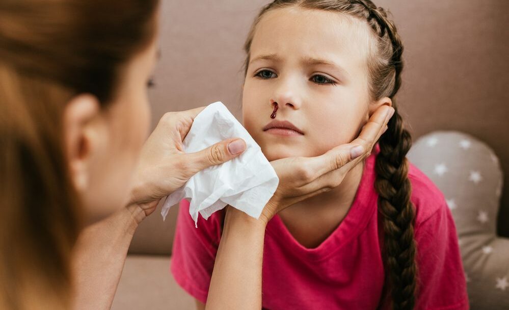 Krvácení z nosu u dětí